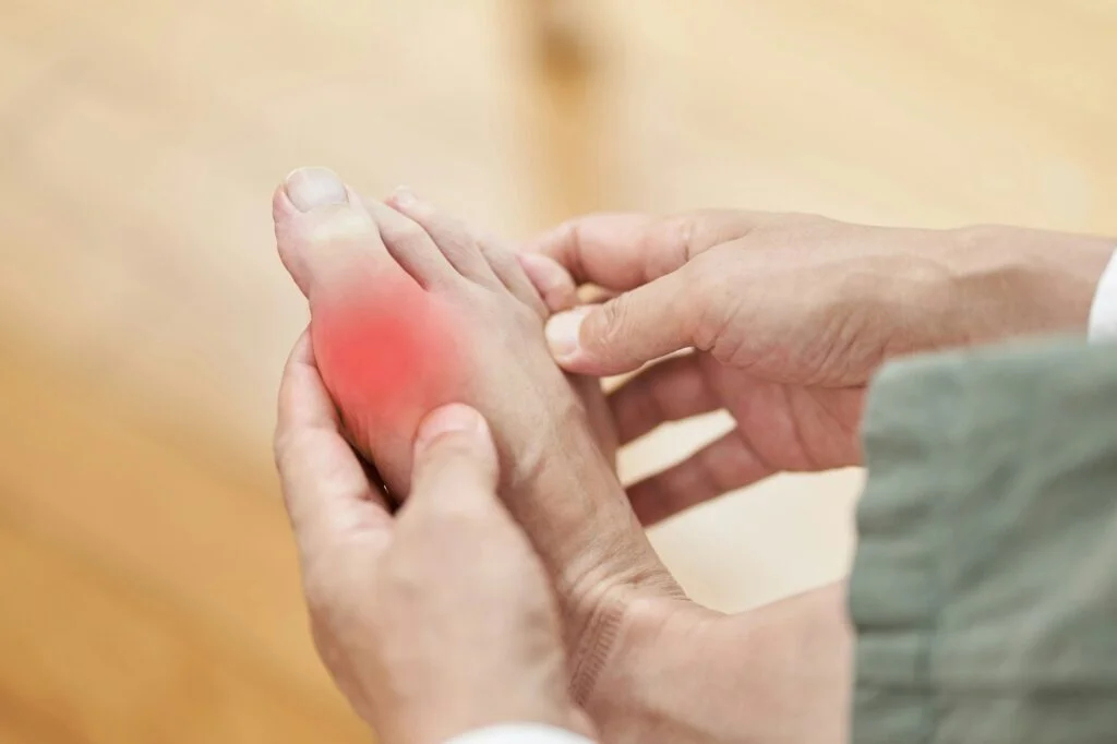 Person with gout pain